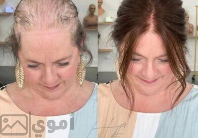 SmartSelect_٢٠٢٥٠٢١١_٢٣٥٨٠٩_Facebook