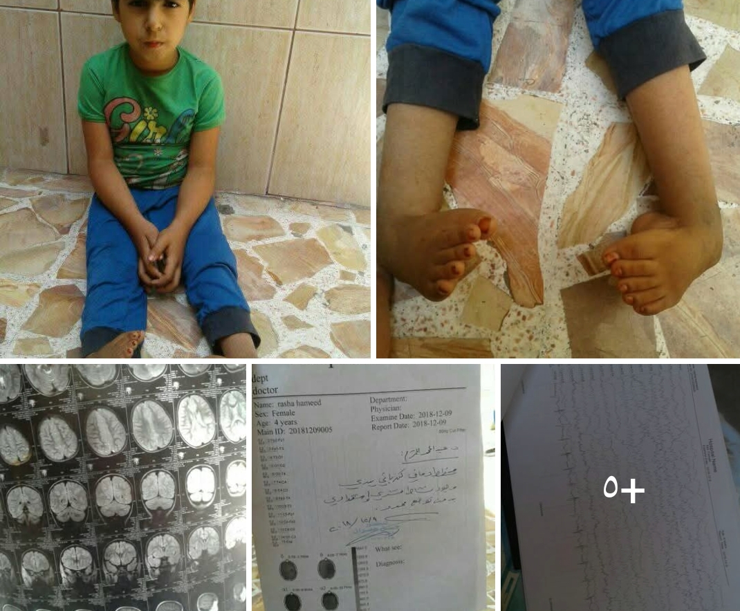 بحاجه لعمليه